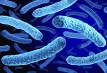 Legionella Risk Assessments: Why they matter Legionella Bacteria